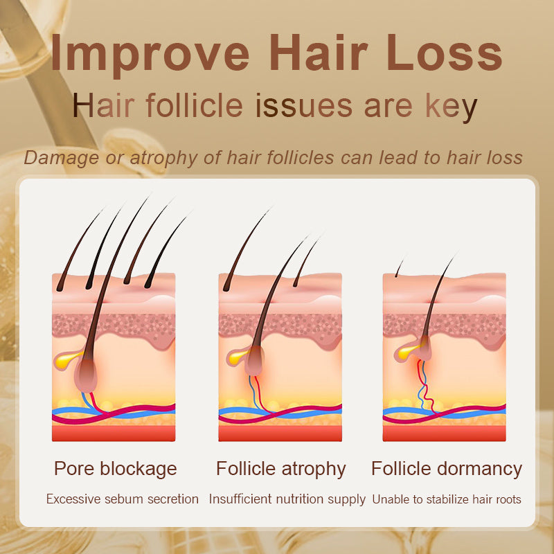 Zhangguang 101 Hair follicle nourishing tonic + 101B Anti-hair Loss ...